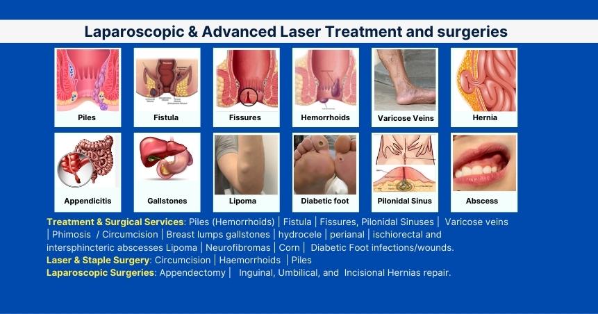 Laparoscopic & Advanced Laser Treatment and Surgeries
